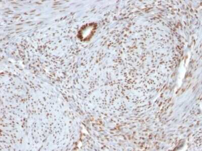 Immunohistochemistry-Paraffin: Nucleolin Antibody (364-5 + NCL/902) [NBP2-44613]