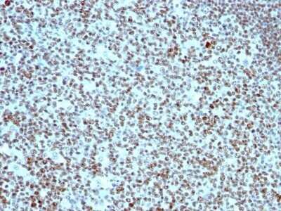 Immunohistochemistry-Paraffin: Nucleolin Antibody (364-5) - Azide and BSA Free [NBP2-47861]