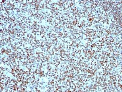 Immunohistochemistry-Paraffin: Nucleolin Antibody (364-5) - IHC-Prediluted [NBP2-48319]
