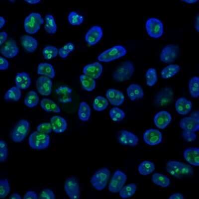 Immunocytochemistry/ Immunofluorescence: Nucleolin Antibody (364-5) [NBP2-44612]