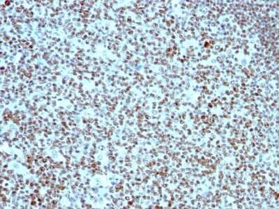 Immunohistochemistry-Paraffin: Nucleolin Antibody (364-5) [NBP2-44612]