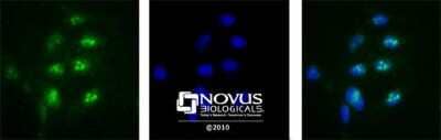 Immunocytochemistry/ Immunofluorescence: Nucleolin Antibody [NB100-1920]