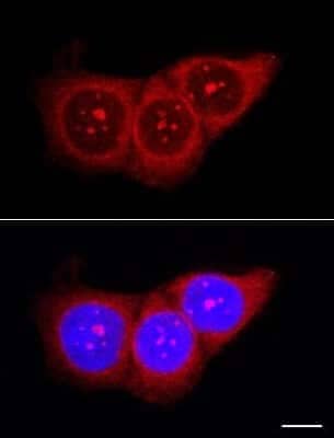 Immunocytochemistry/ Immunofluorescence: Nucleolin Antibody [NB600-241]