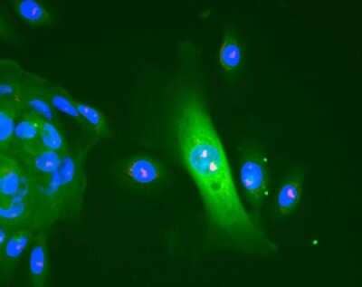 Immunocytochemistry/ Immunofluorescence: Nucleolin Antibody [NB600-241]