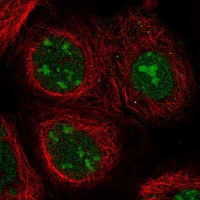 Immunocytochemistry/ Immunofluorescence: Nucleolin Antibody [NBP1-88271]