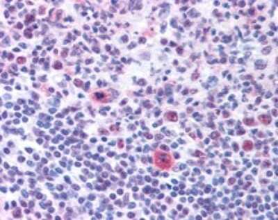 Immunohistochemistry: Nucleolin Antibody [NB600-241]