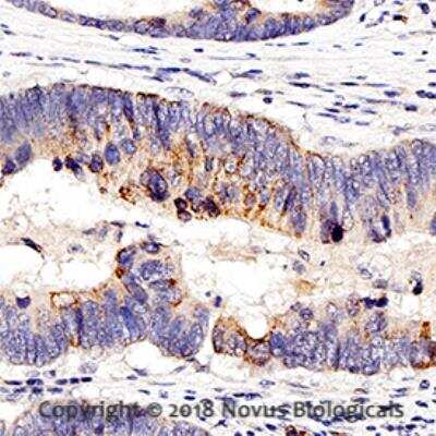 Immunohistochemistry-Paraffin: Nucleolin Antibody [NB100-1920]