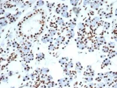Immunohistochemistry-Paraffin: Nucleolin Antibody (NCL/7014R) - Azide and BSA Free [NBP3-11038]