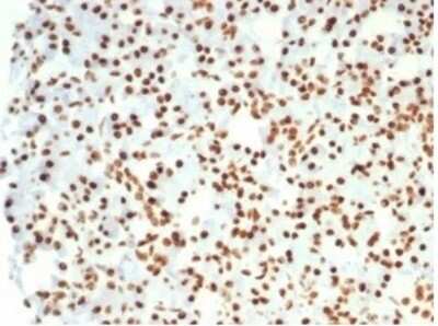 Immunohistochemistry-Paraffin: Nucleolin Antibody (NCL/7014R) - Azide and BSA Free [NBP3-11038]