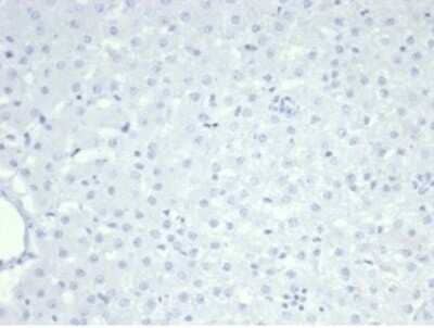 Immunohistochemistry-Paraffin: Nucleolin Antibody (NCL/7014R) - Azide and BSA Free [NBP3-11038]