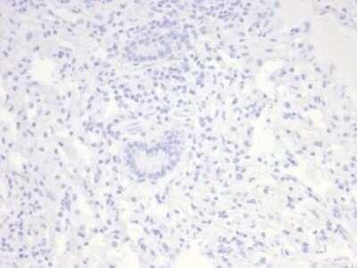Immunohistochemistry-Paraffin: Nucleolin Antibody (NCL/7014R) - Azide and BSA Free [NBP3-11038]