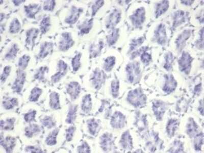 Immunohistochemistry-Paraffin: Nucleolin Antibody (NCL/7014R) - Azide and BSA Free [NBP3-11038]