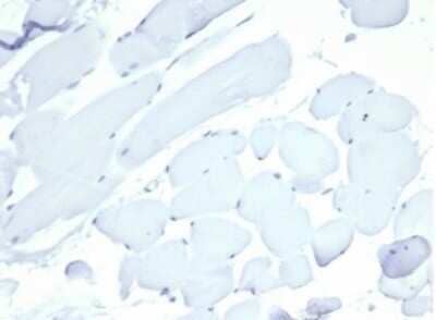 Immunohistochemistry-Paraffin: Nucleolin Antibody (NCL/7014R) - Azide and BSA Free [NBP3-11038]