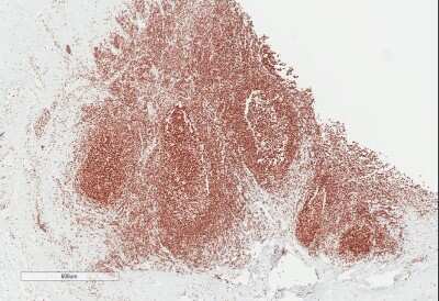 Immunohistochemistry-Paraffin: Nucleolin Antibody (NCL/7014R) [NBP3-11037]