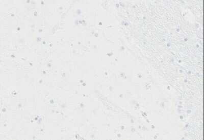 Immunohistochemistry-Paraffin: Nucleolin Antibody (NCL/7014R) [NBP3-11037]