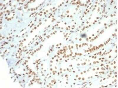 Immunohistochemistry-Paraffin: Nucleolin Antibody (NCL/7014R) [NBP3-11037]