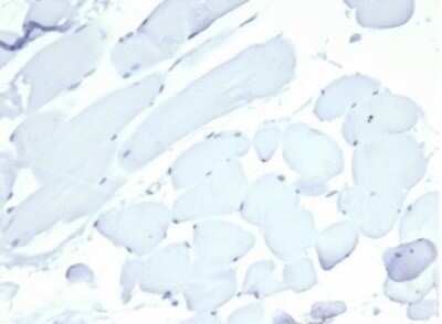 Immunohistochemistry-Paraffin: Nucleolin Antibody (NCL/7014R) [NBP3-11037]