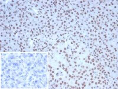 Immunohistochemistry-Paraffin: Nucleolin Antibody (NCL/7338) [NBP3-13980]