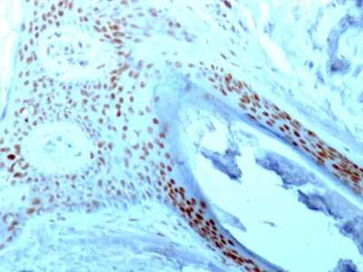 Immunohistochemistry-Paraffin: Nucleolin Antibody (NCL/902) - Azide and BSA Free [NBP2-47860]