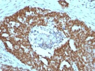 Immunohistochemistry-Paraffin: Nucleolin Antibody (NCL/902) - IHC-Prediluted [NBP2-48317]