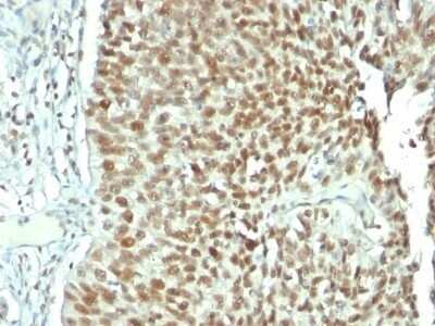 Immunohistochemistry-Paraffin: Nucleolin Antibody (NCL/902) - IHC-Prediluted [NBP2-48317]