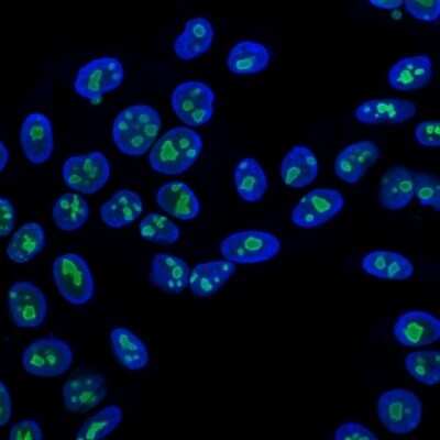 Immunocytochemistry/ Immunofluorescence: Nucleolin Antibody (NCL/902) [NBP2-44610]