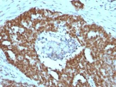 Immunohistochemistry-Paraffin: Nucleolin Antibody (NCL/902) [NBP2-44610]