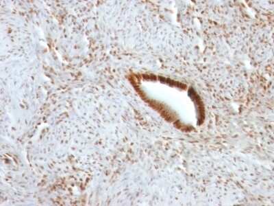 Immunohistochemistry-Paraffin: Nucleolin Antibody (NCL/902) [NBP2-44610]