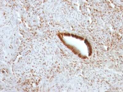 Immunohistochemistry-Paraffin: Nucleolin Antibody (NCL/902) [NBP2-44610]