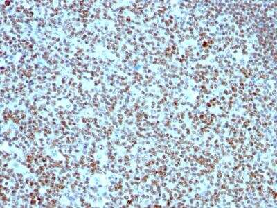 Immunohistochemistry-Paraffin: Nucleolin Antibody (SPM614) - IHC-Prediluted [NBP2-48318]