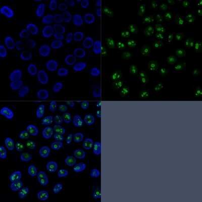 Immunocytochemistry/ Immunofluorescence: Nucleolin Antibody (SPM614) [NBP2-44611]