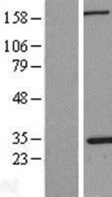 Western Blot: NPM1 Overexpression Lysate [NBL1-13748]