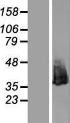 Western Blot: NPM1 Overexpression Lysate [NBL1-13749]