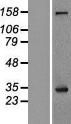 Western Blot: NPM1 Overexpression Lysate [NBL1-13750]