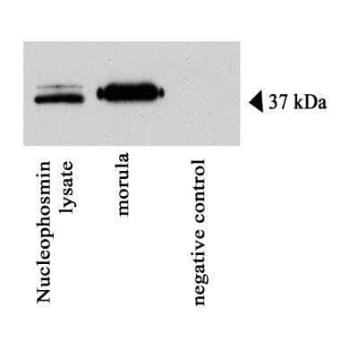 Western Blot: NPM1 Overexpression Lysate [NBL1-13748]