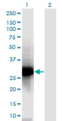 Western Blot: Nucleoplasmin-2 Antibody (5E9) [H00010361-M03]