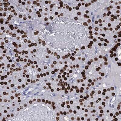 Immunohistochemistry-Paraffin: Nucleoplasmin-2 Antibody [NBP2-13673]