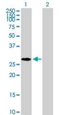 Western Blot: Nucleoplasmin-2 Antibody [H00010361-B01P]