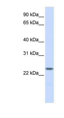 Western Blot: Nucleoplasmin-2 Antibody [NBP1-58109]