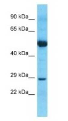 Western Blot: Nucleoplasmin-2 Antibody [NBP3-09372]