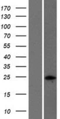 Western Blot: Nucleoplasmin-2 Overexpression Lysate [NBP2-04813]