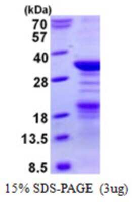 SDS-PAGE: Recombinant Human Nucleoplasmin-2 His Protein [NBP2-23301]