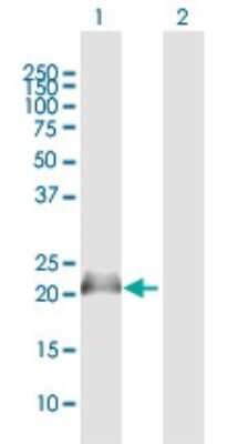 Western Blot: Nucleoplasmin-3 Antibody [H00010360-B01P]