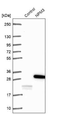 Western Blot: Nucleoplasmin-3 Antibody [NBP1-90999]