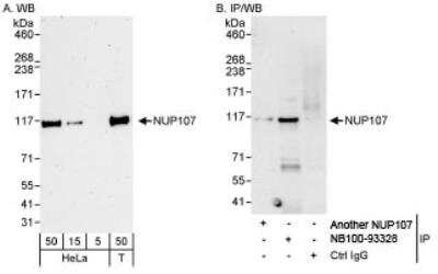 Western Blot: Nucleoporin 107 Antibody [NB100-93328]