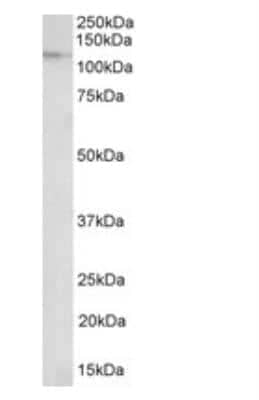 Western Blot: Nucleoporin 107 Antibody [NBP1-49841]