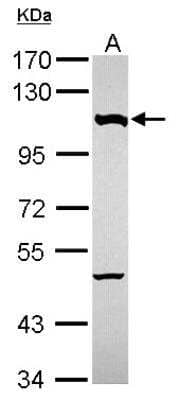 Western Blot: Nucleoporin 107 Antibody [NBP2-19602]