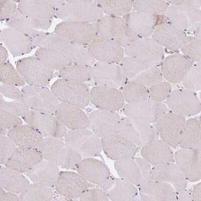 Immunohistochemistry-Paraffin: Nucleoporin NUP85 Antibody [NBP2-31860]