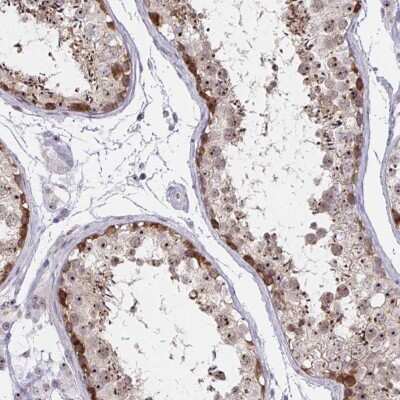 Immunohistochemistry-Paraffin: Nucleoporin NUP85 Antibody [NBP2-31860]