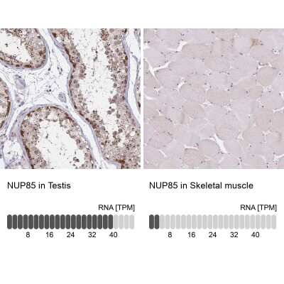 Immunohistochemistry-Paraffin: Nucleoporin NUP85 Antibody [NBP2-31860]